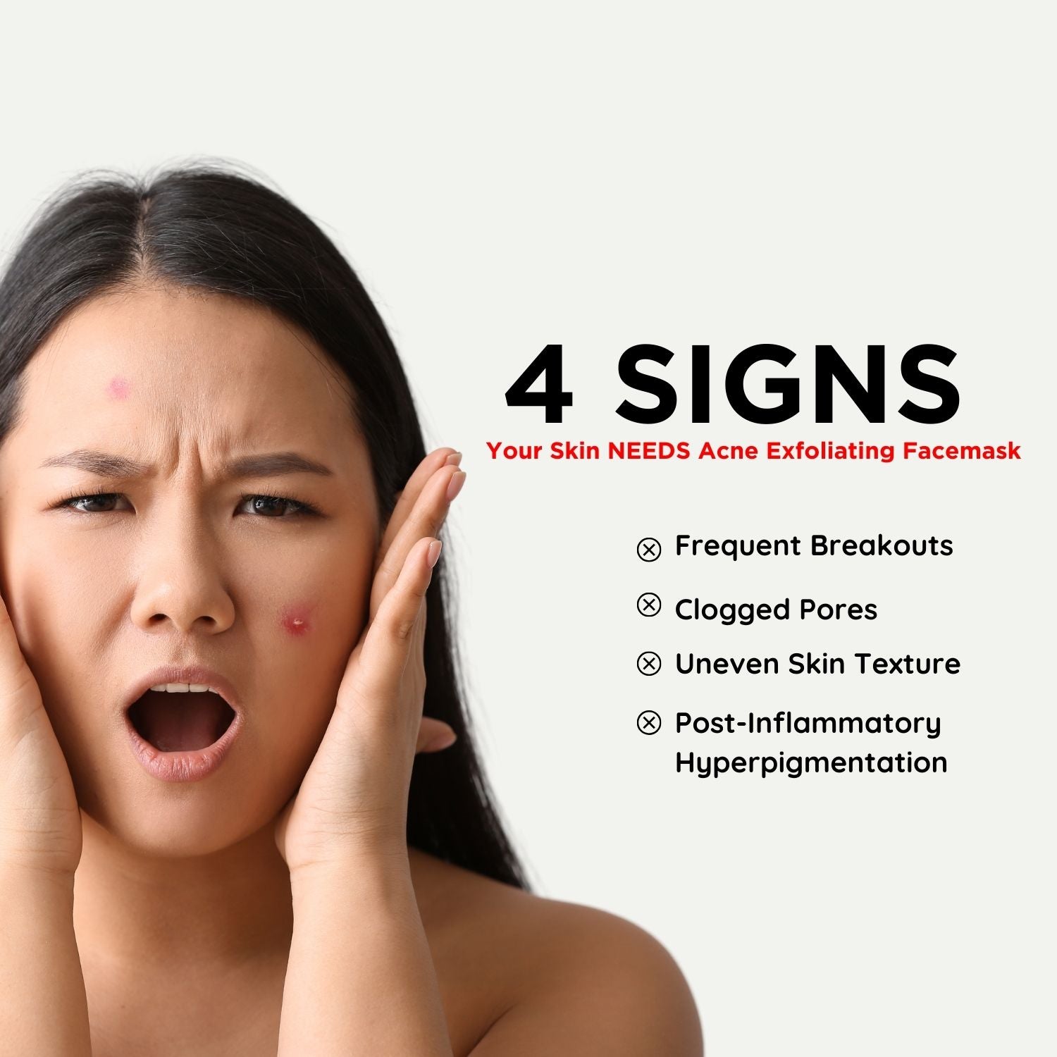 4 signs of acne your skin needs revive acne facemask